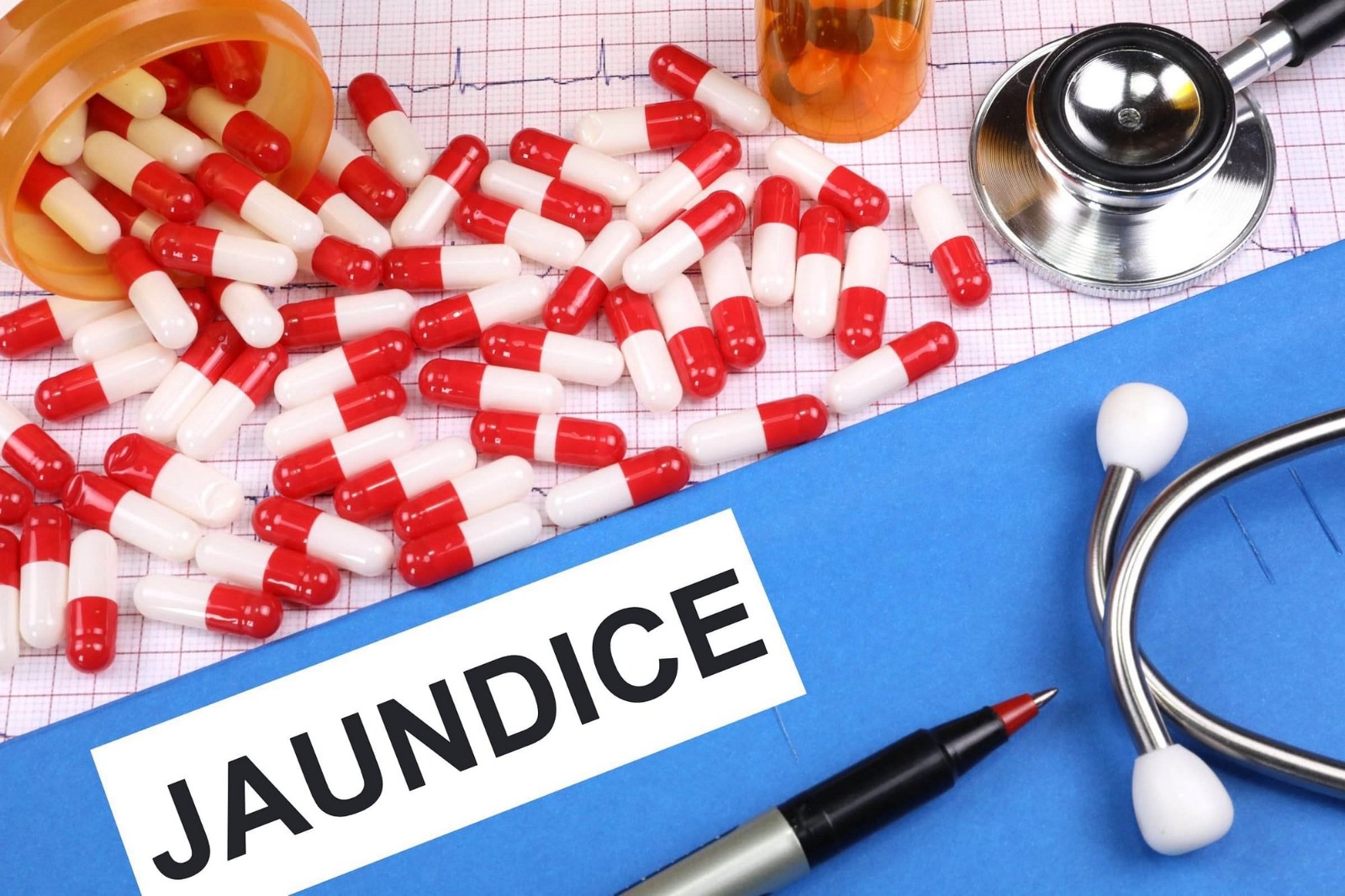 Six Students Diagnosed with Jaundice in Anantnag School