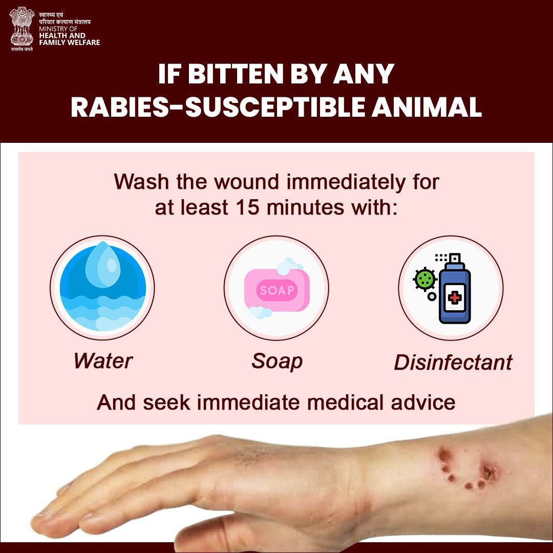 Rabies is preventable with the right first response! Rabies is preventable with the right first response!