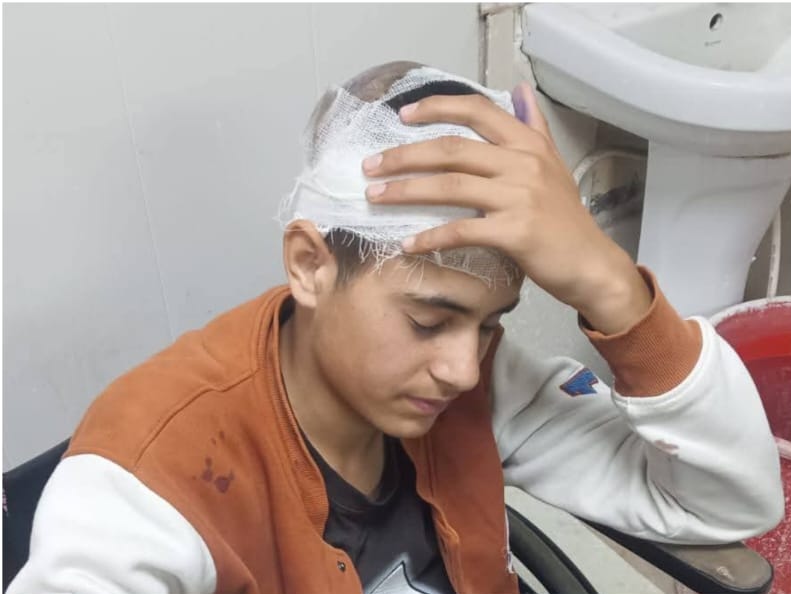 18-Year-Old Kashmiri Shawl Seller Assaulted in Uttarakhand’s Vikas Nagar, Suffers Fractures and Head Injuries